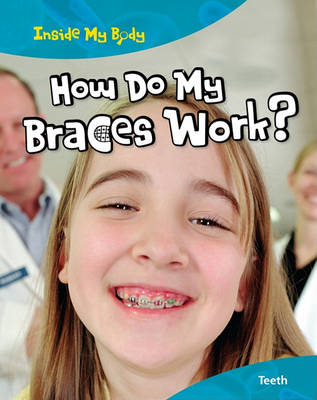 Book cover for How Do My Braces Work?
