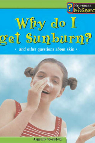 Cover of Body Matters Why do I get sunburn Paperback