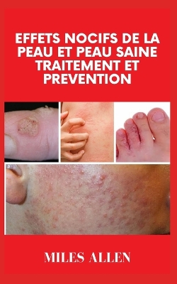 Book cover for Effets Nocifs de la Peau Et Peau Saine Traitement Et Prevention