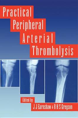 Cover of Practical Peripheral Arterial Thrombolysis