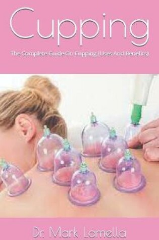 Cover of Cupping