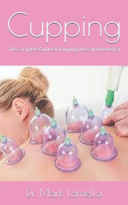 Book cover for Cupping