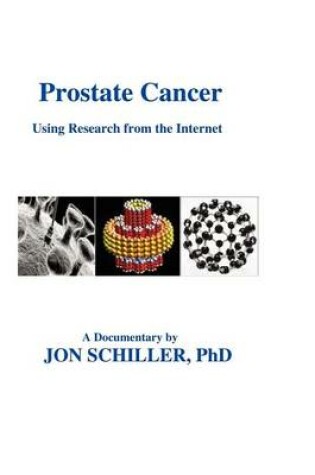 Cover of Prostate Cancer