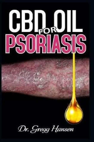 Cover of CBD Oil for Psoriasis