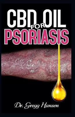 Book cover for CBD Oil for Psoriasis