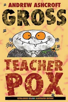Book cover for Gross Teacherpox