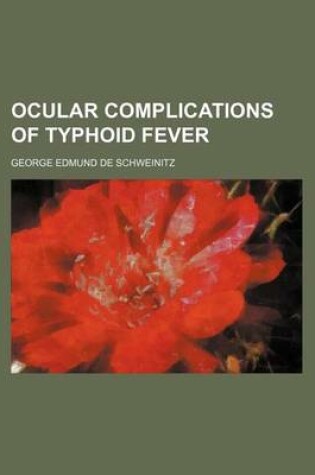 Cover of Ocular Complications of Typhoid Fever