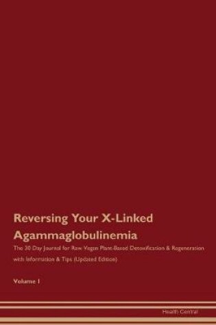 Cover of Reversing Your X-Linked Agammaglobulinemia