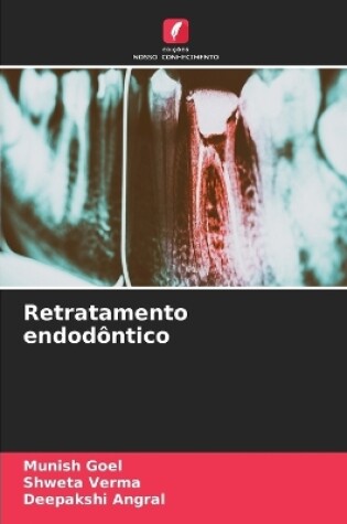 Cover of Retratamento endodôntico