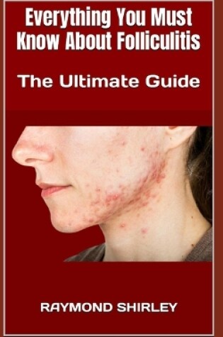 Cover of Everything You Must Know About Folliculitis