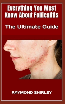 Book cover for Everything You Must Know About Folliculitis