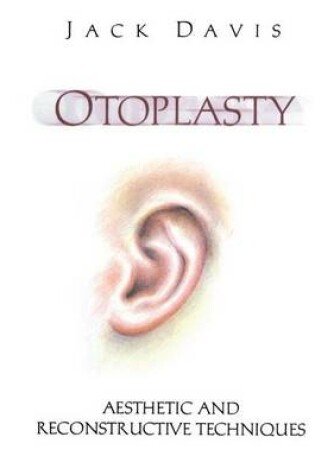 Cover of Otoplasty