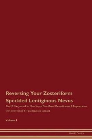 Cover of Reversing Your Zosteriform Speckled Lentiginous Nevus