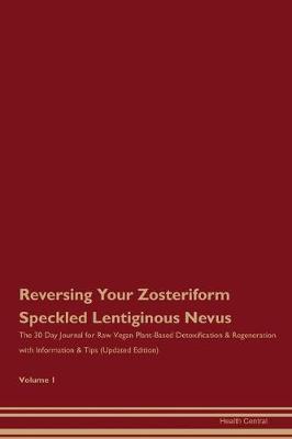 Book cover for Reversing Your Zosteriform Speckled Lentiginous Nevus