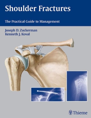 Book cover for Shoulder Fractures