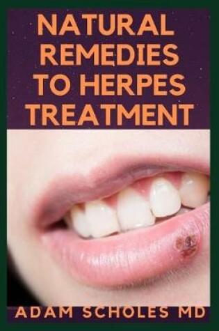 Cover of Natural Remedies to Herpes Treatment