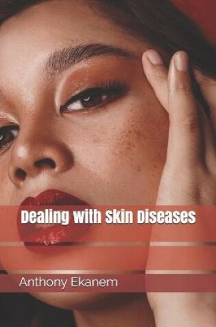 Cover of Dealing with Skin Diseases