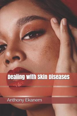 Book cover for Dealing with Skin Diseases