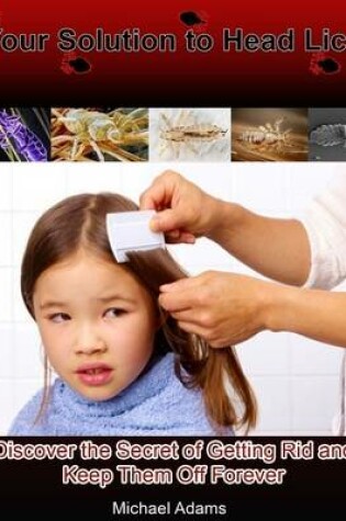 Cover of Your Solution to Head Lice: Discover the Secret of Getting Rid and Keep Them Off Forever