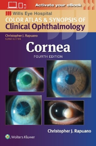 Cover of Cornea