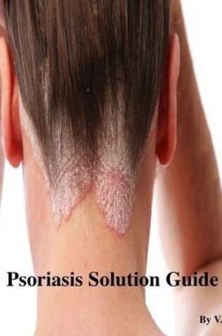 Cover of Psoriasis Solution Guide