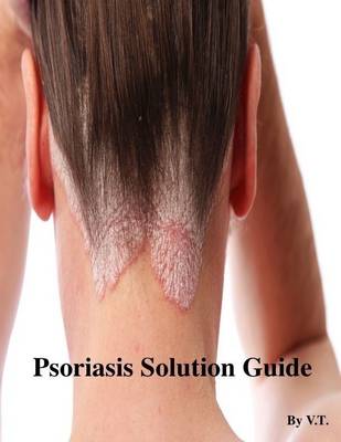 Book cover for Psoriasis Solution Guide