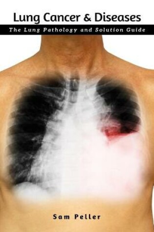 Cover of Lung Cancer & Diseases