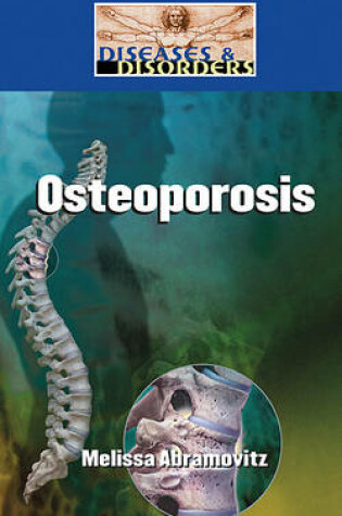 Cover of Osteoporosis