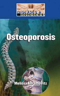 Book cover for Osteoporosis