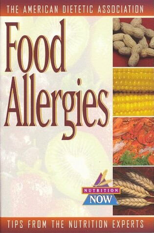 Cover of Food Allergies