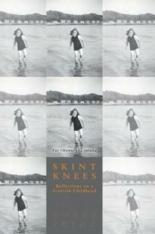 Cover of Skint Knees