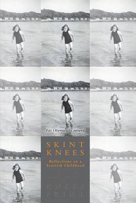 Book cover for Skint Knees