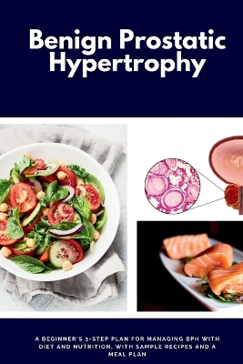 Book cover for Benign Prostatic Hypertrophy