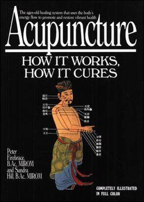 Book cover for Acupuncture: How It Works, How It Cures