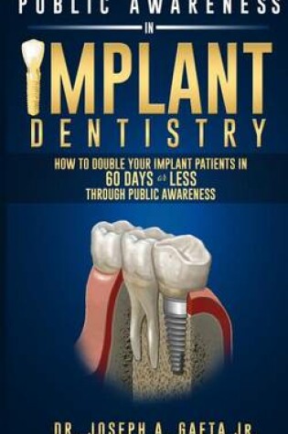 Cover of Public Awareness In Implant Dentistry