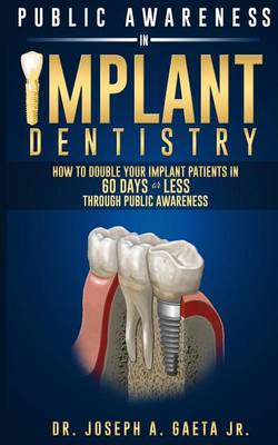 Book cover for Public Awareness In Implant Dentistry