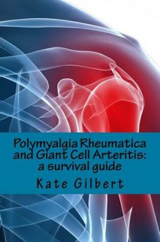 Cover of Polymyalgia Rheumatica and Giant Cell Arteritis