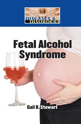 Book cover for Fetal Alcohol Syndrome