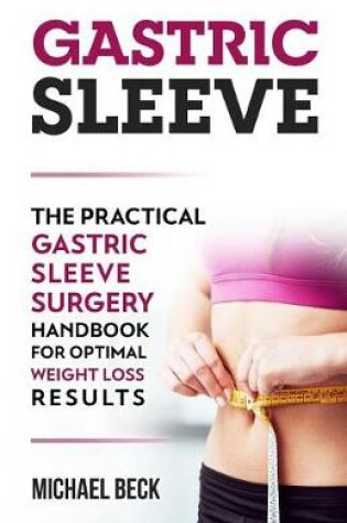 Cover of Gastric Sleeve