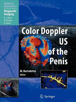 Book cover for Color Doppler Us of the Penis