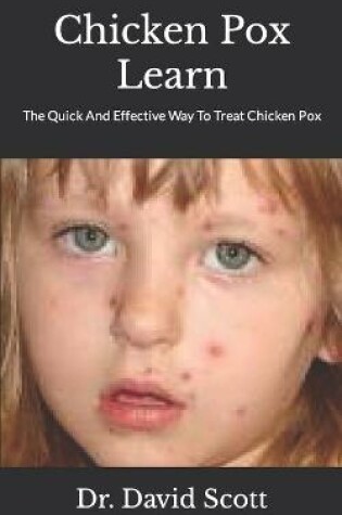 Cover of Chicken Pox Learn
