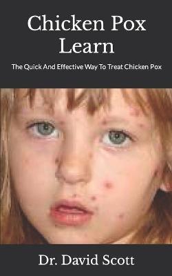 Book cover for Chicken Pox Learn